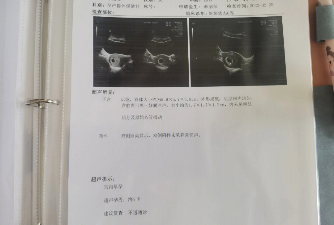 4周就测出怀孕了,两个星期了,还看不到胎心胎芽