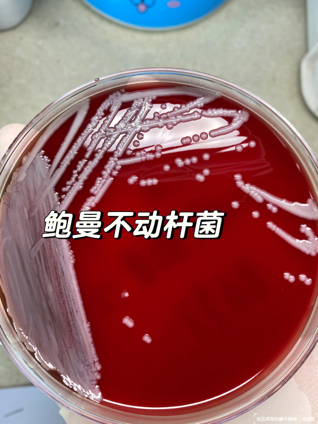 16615形态:革兰阴性球杆菌,大小(1~15)μm × (15~2