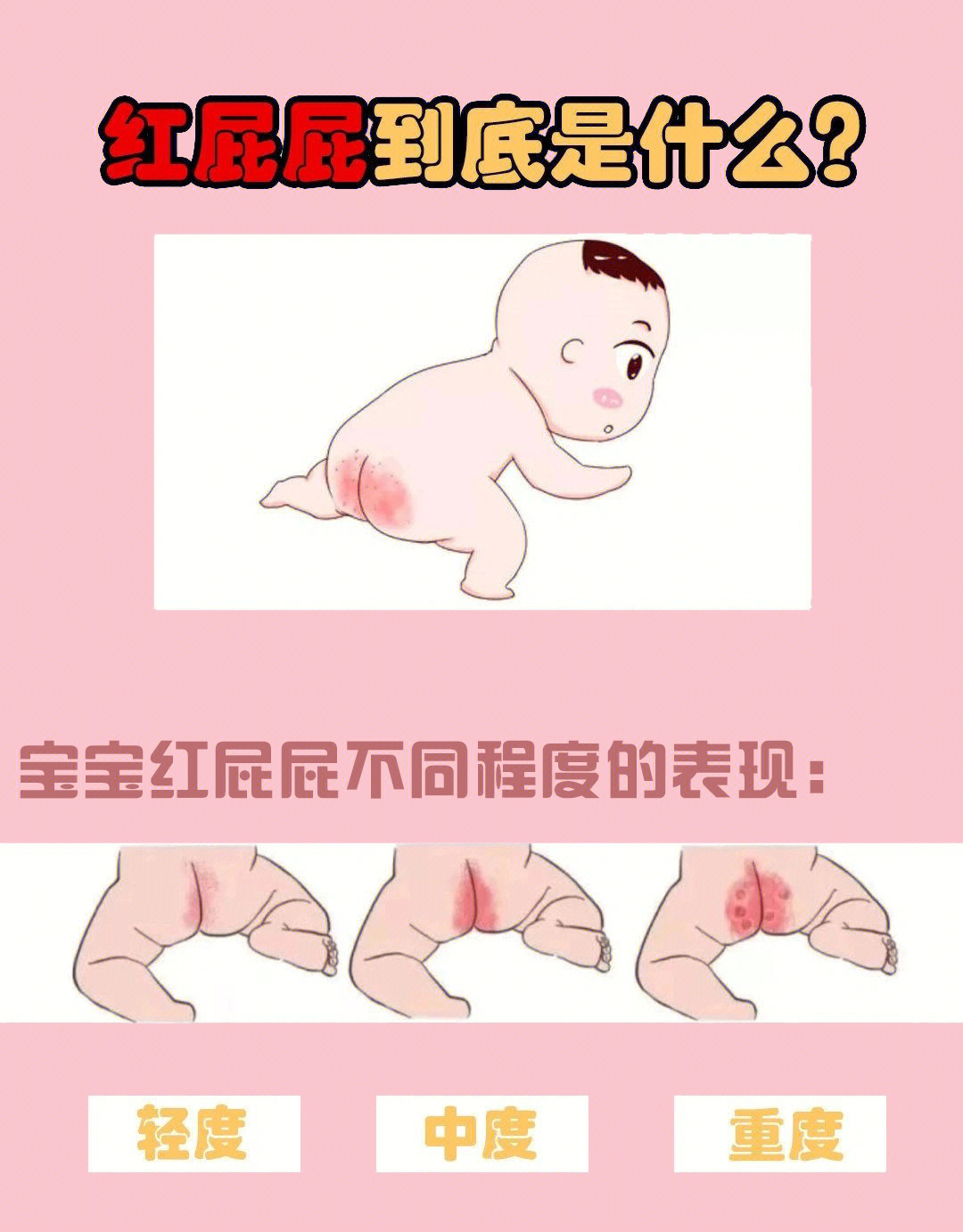 宝宝屁股有红疹怎么办图片