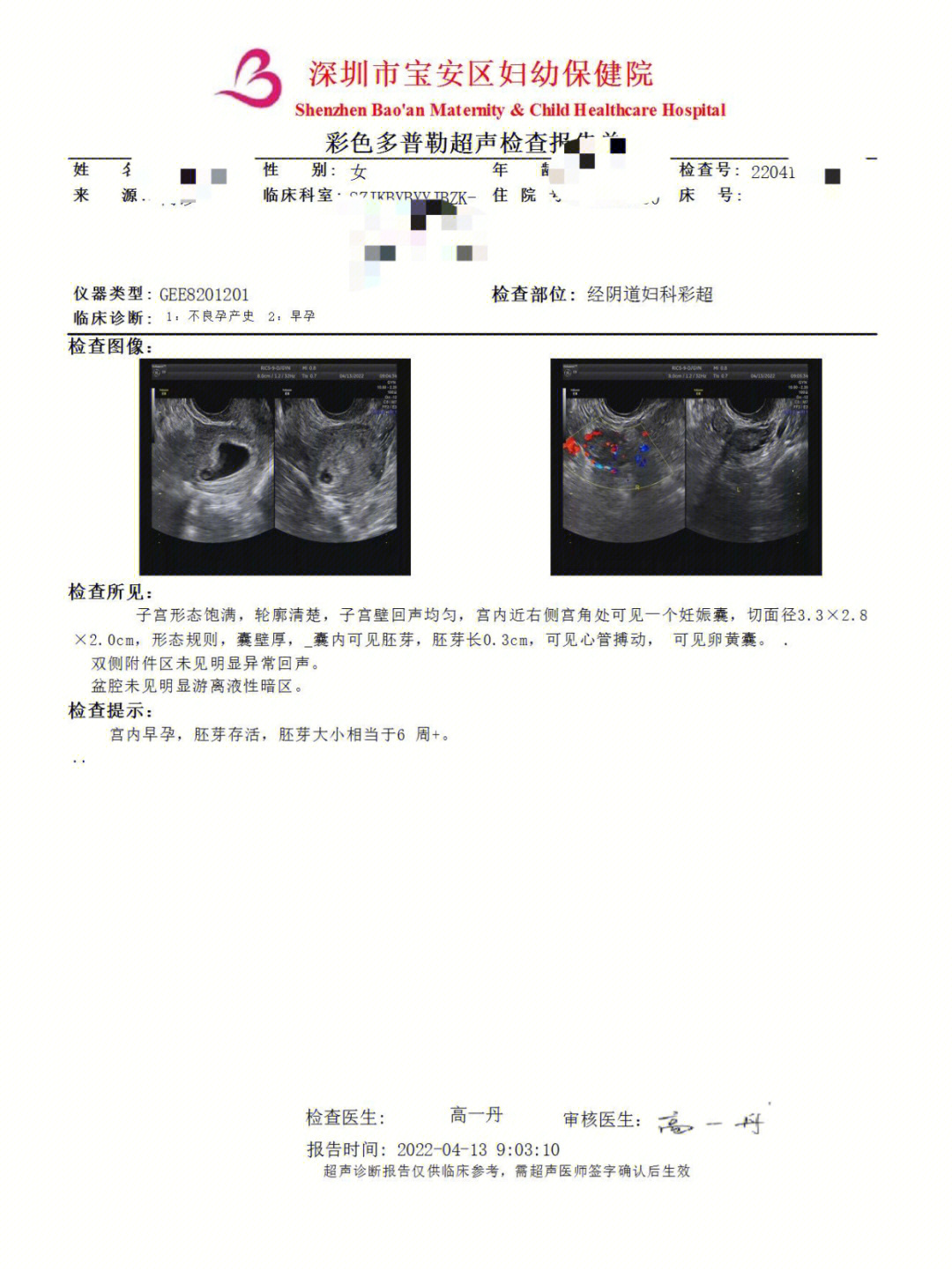 宫角妊娠彩超图片