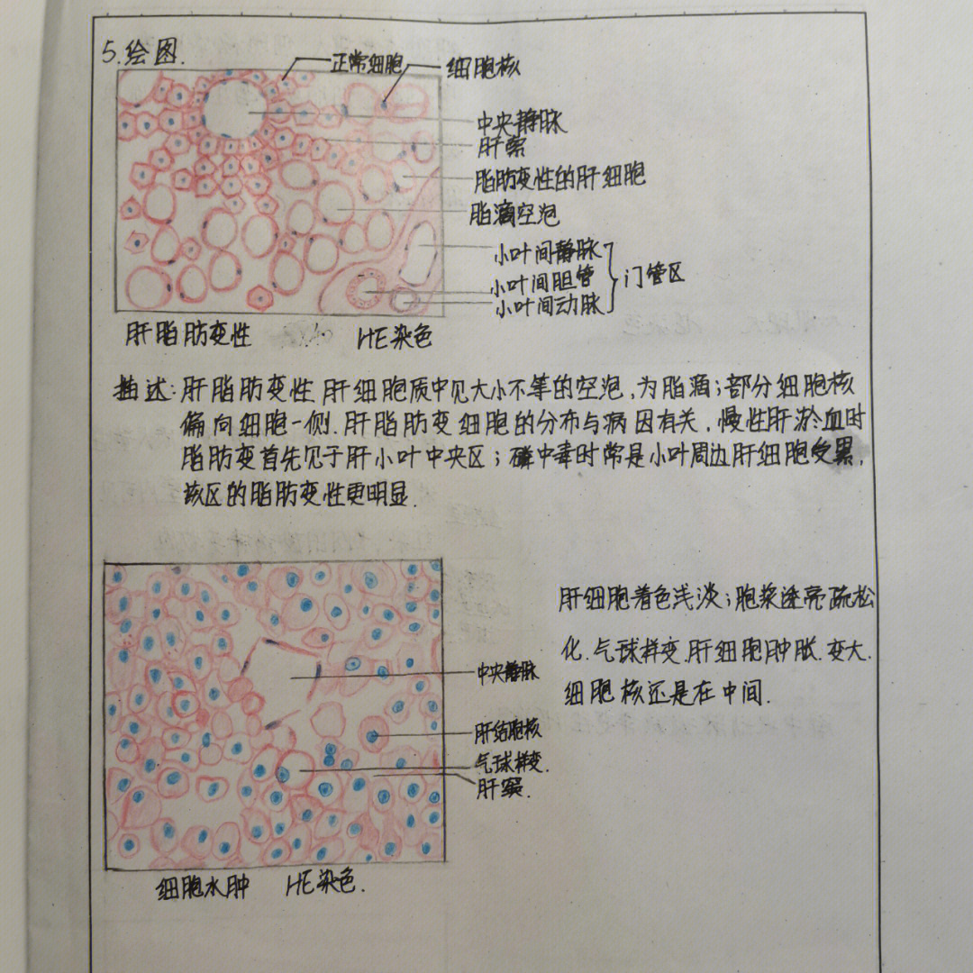 淋巴细胞转化试验绘图图片