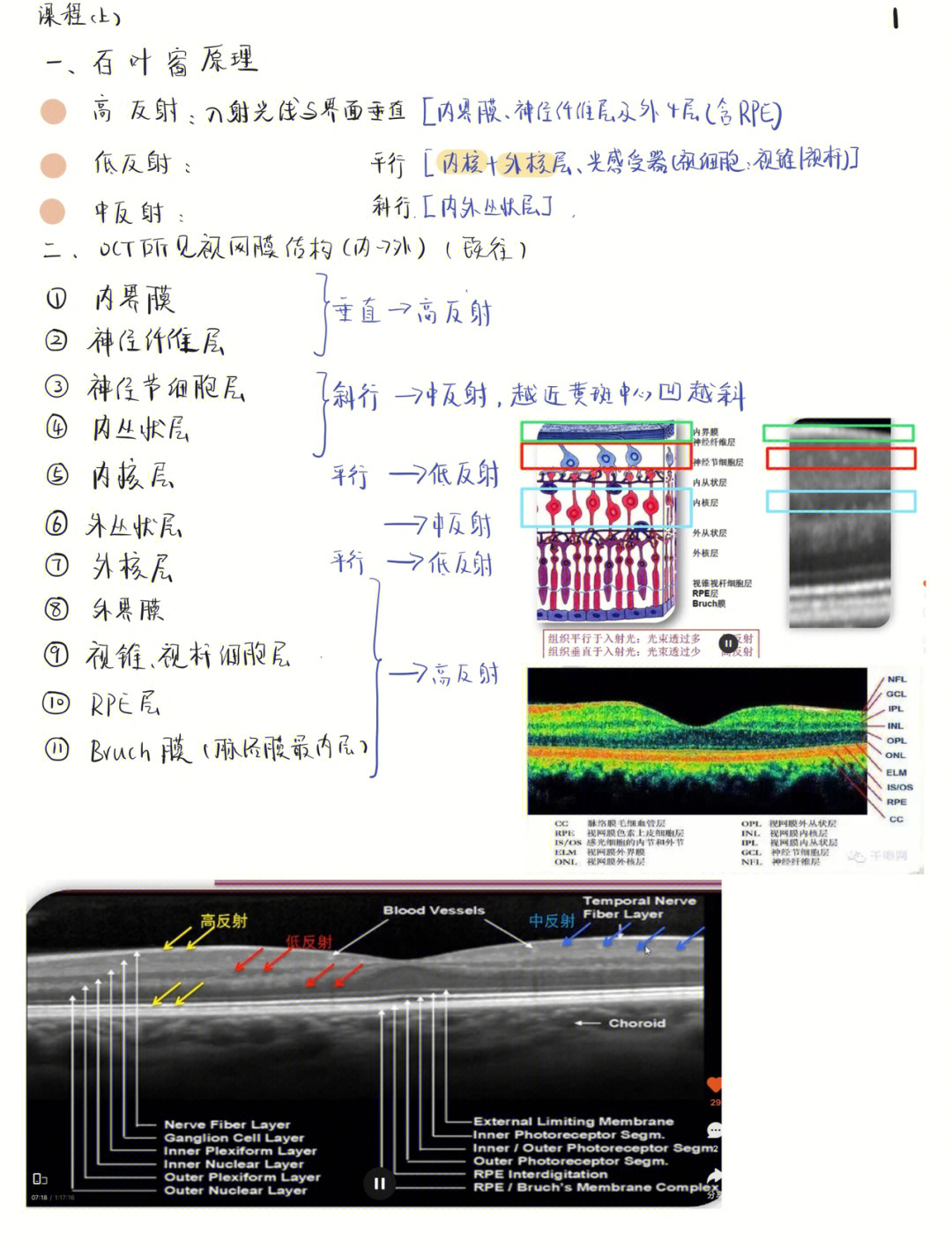 眼科oct检查图解红绿色图片