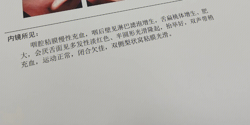 检查:去到@北京首大眼耳鼻喉医院检查,医生听了症状以后疑似鼻炎,做了