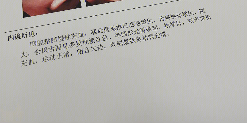 淋巴滤泡会自己消失吗图片