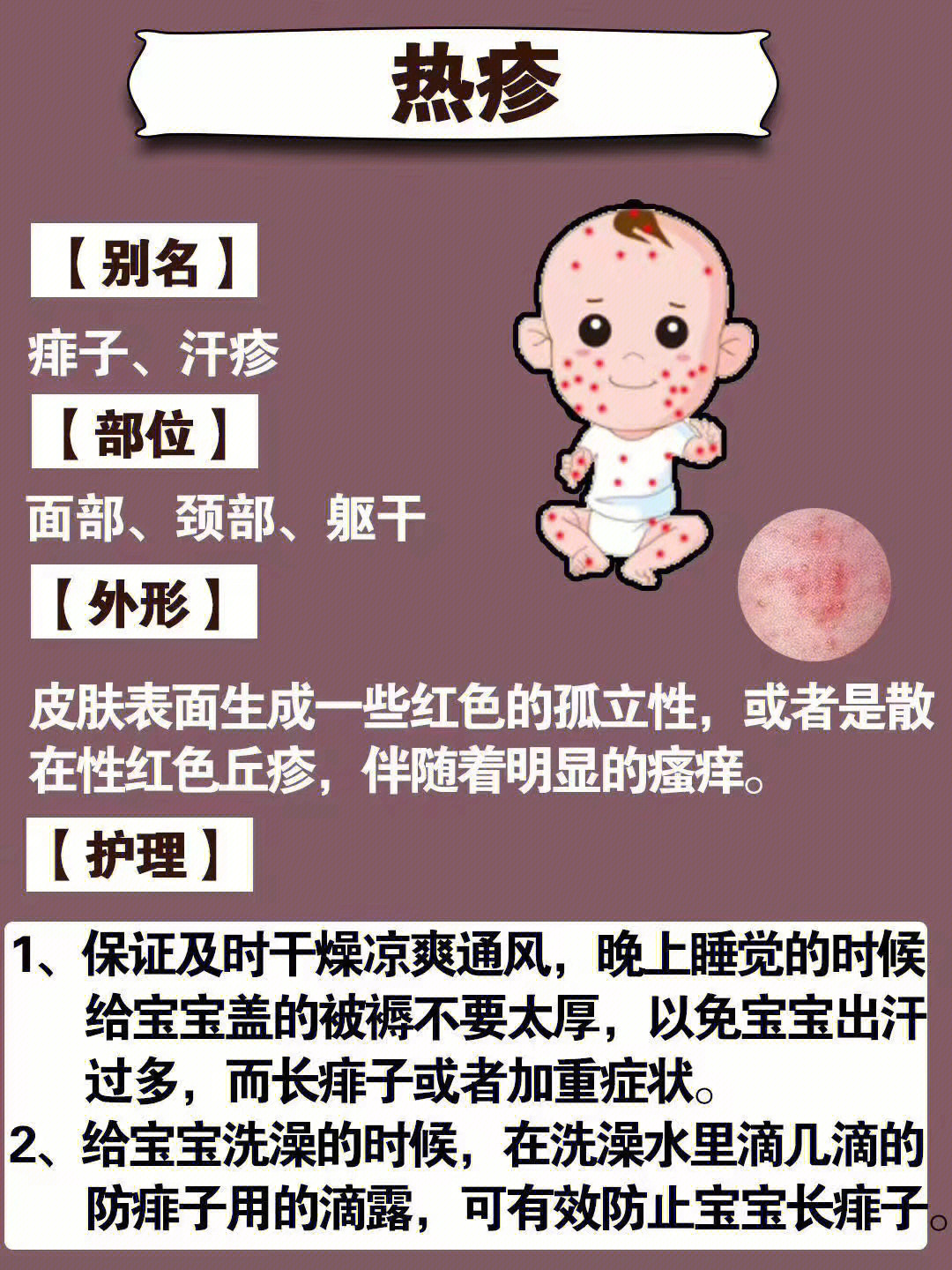 婴儿脖子汗疱疹图片