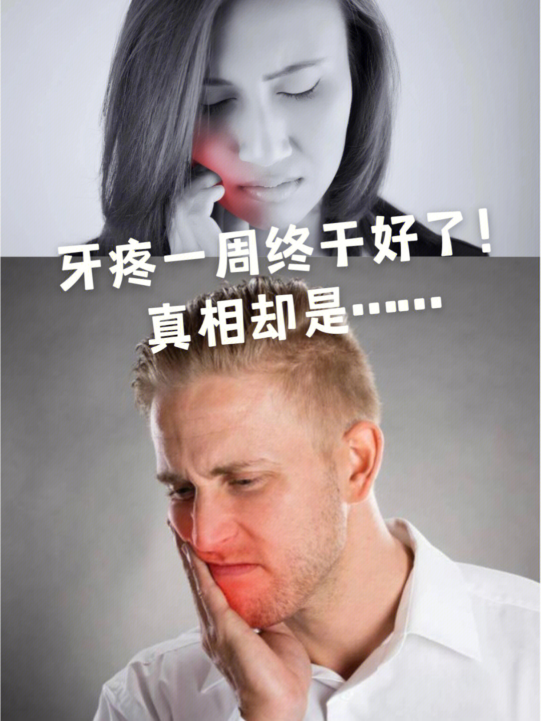 牙髓炎会自愈吗图片