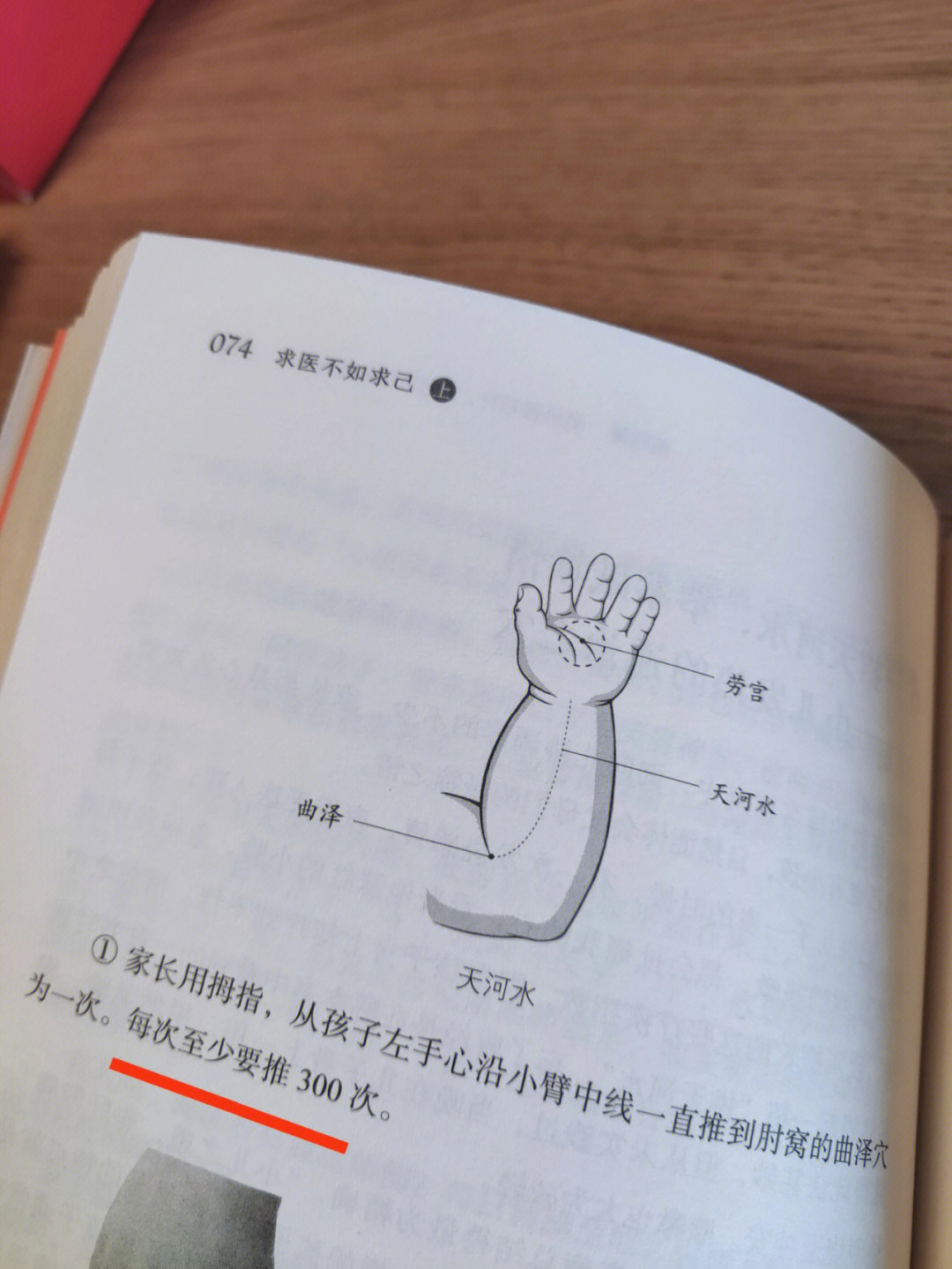 孩子夜里发烧咳嗽手脚心发热出汗这种热性病症可以推天河水(如图)能