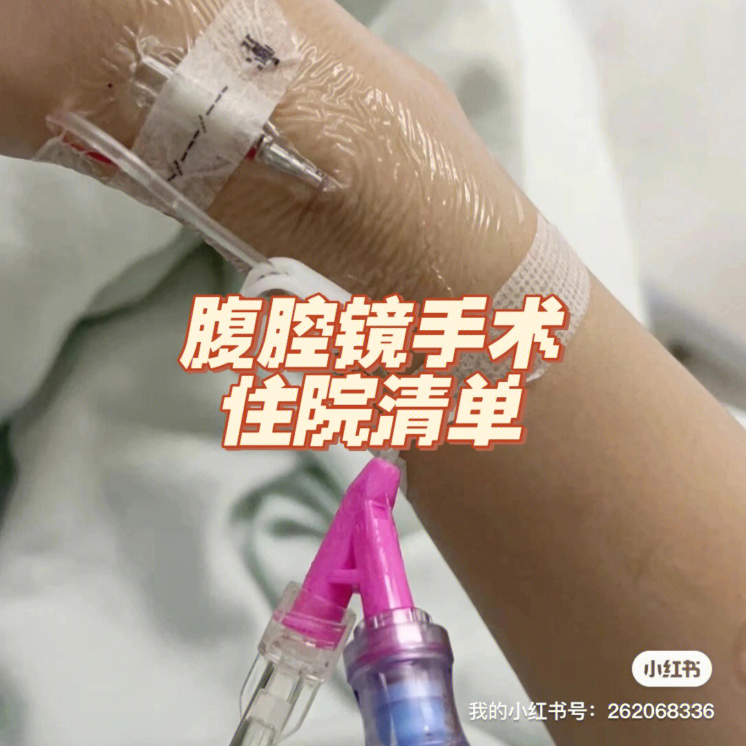 巧囊经验之谈腹腔镜手术住院必备清单