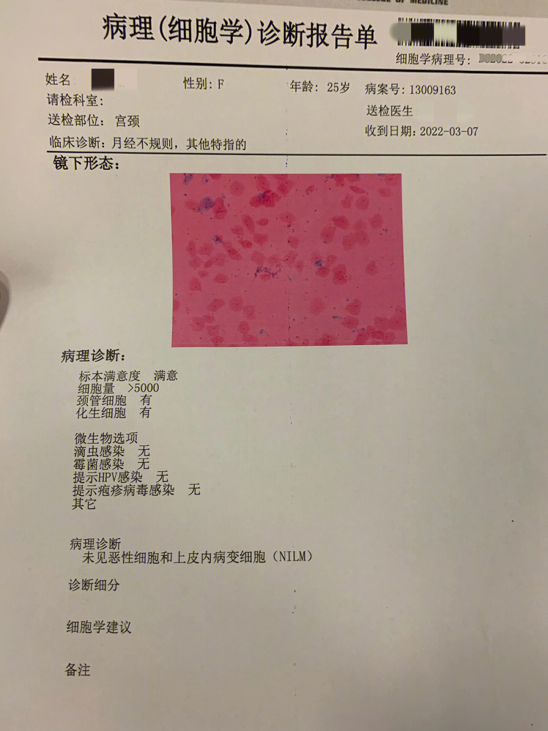 tct阳性图片