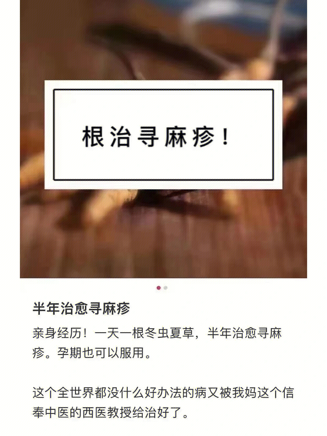 荨麻疹的朋友看过来