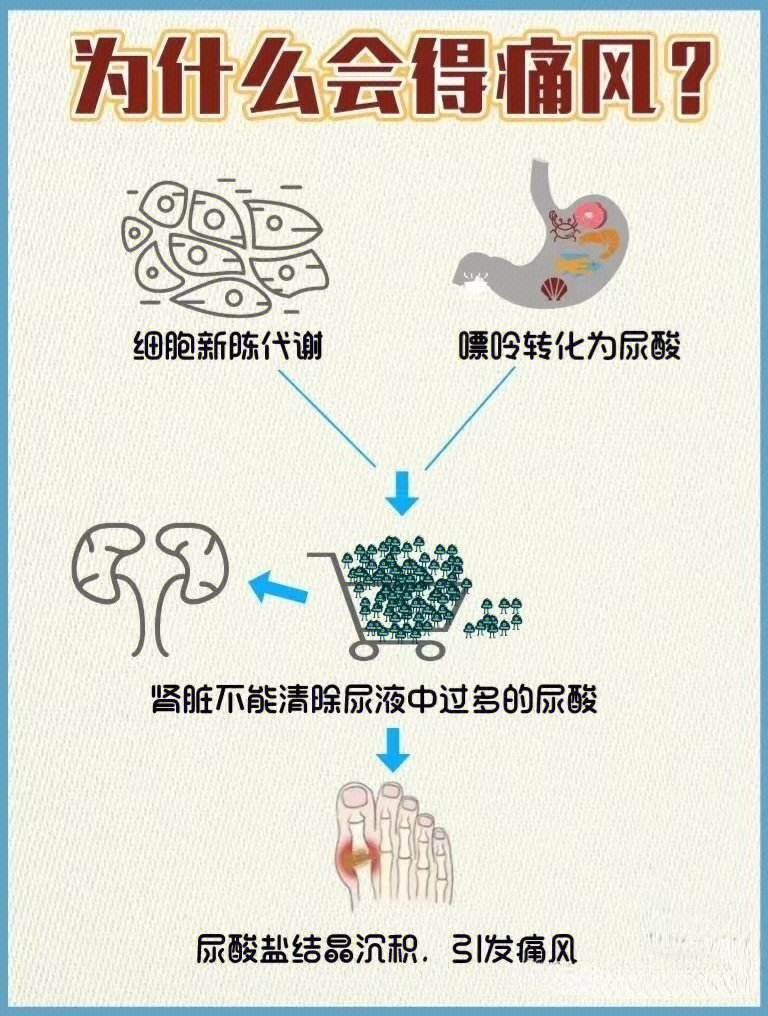 痛风知识科普痛风九大误区166文全攻略