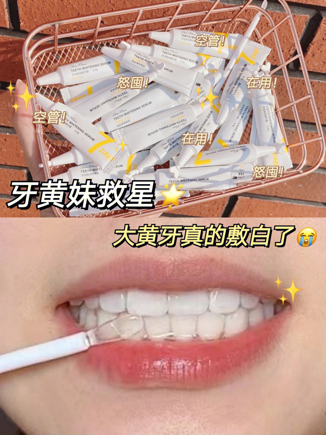大黄牙怎么变成大白牙图片