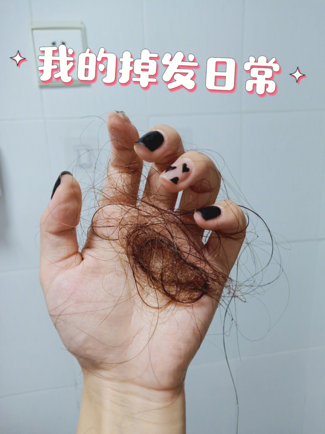 脑袋瓜要秃了再多头发经不起这么掉呀