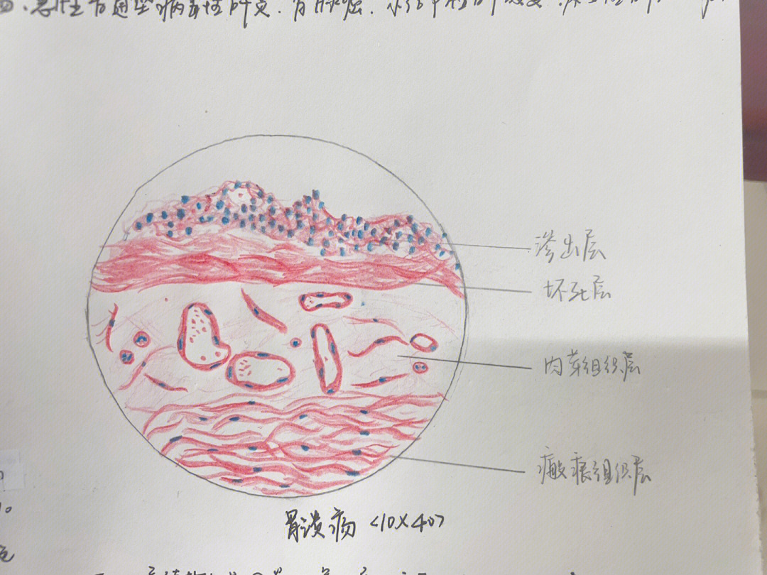 胃底红蓝铅笔手绘图图片