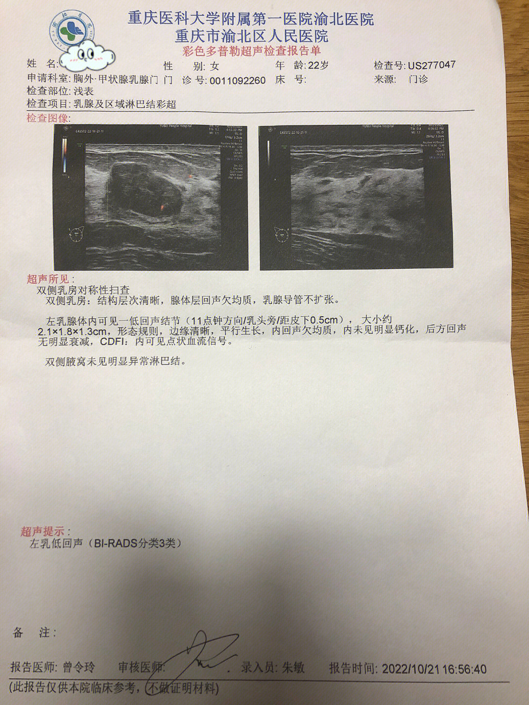 男性乳腺发育超声报告图片