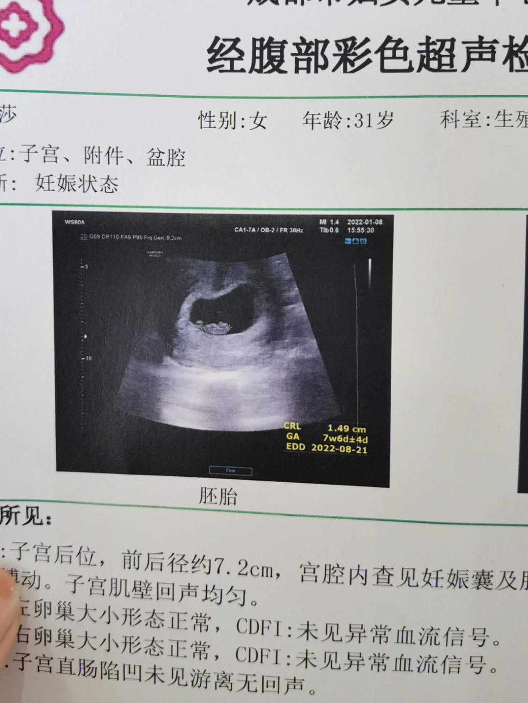 怀孕8周是多少天图片