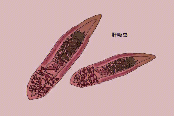 [彩虹r]华支睾吸虫简称肝吸虫,是当前我国感染人数最多的食源性寄生虫