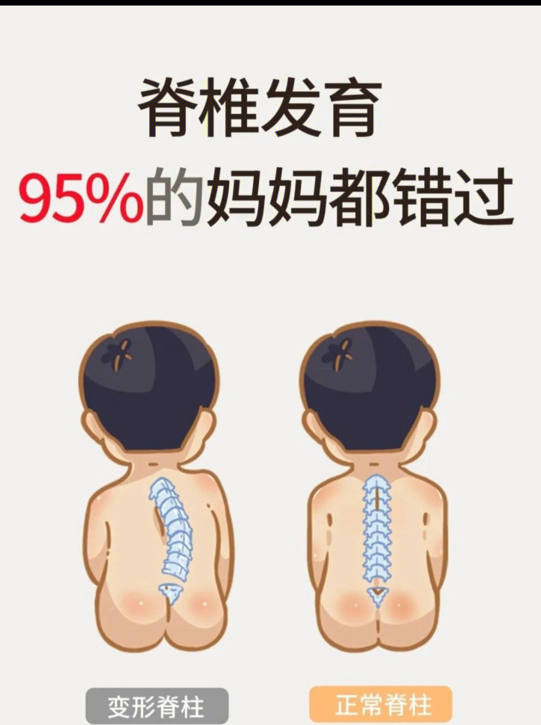 4%的儿童出现脊柱变形.