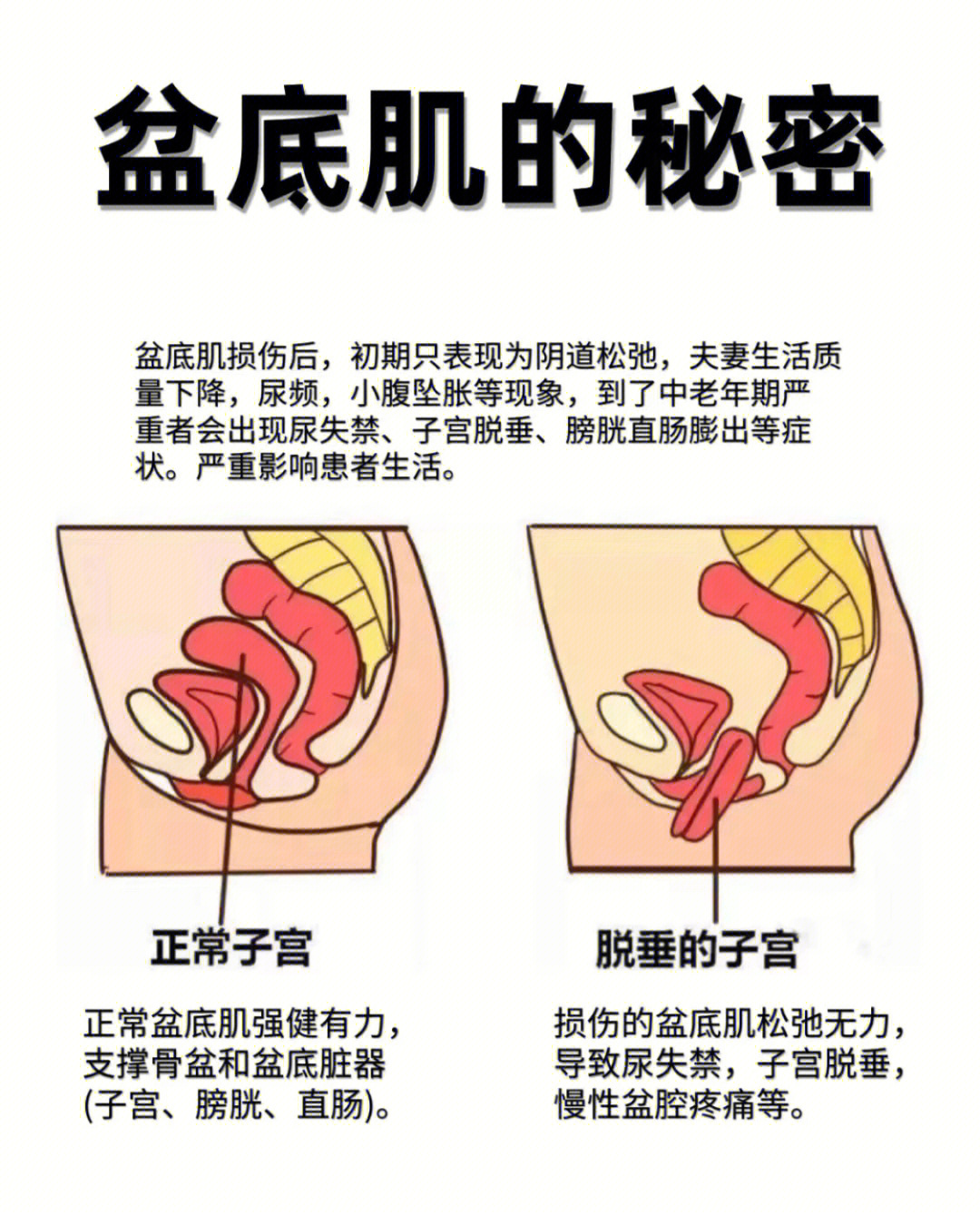 盆底浅层肌肉图片