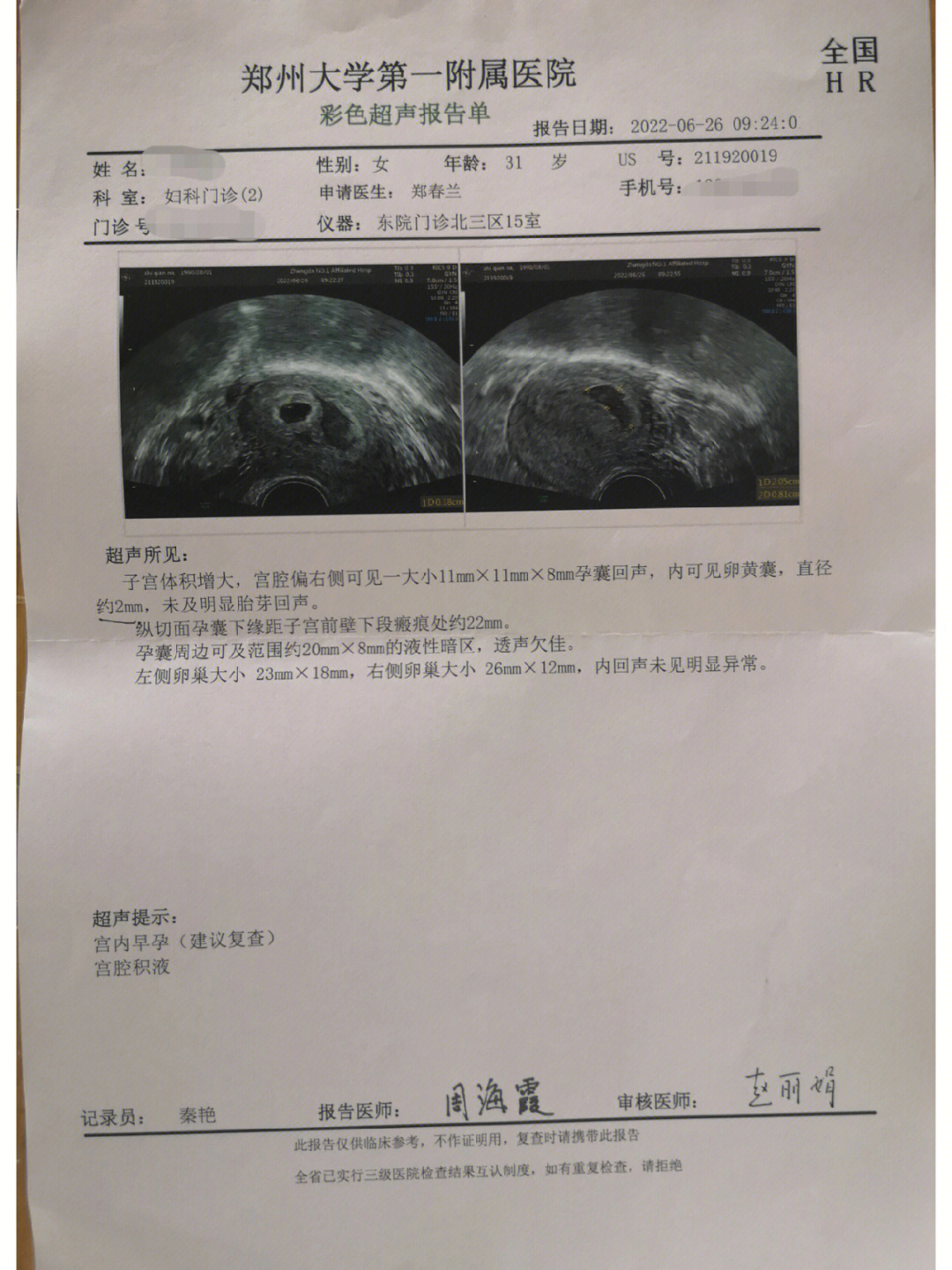 18,619早上自己试纸测出怀孕,过了一周终于去医院检查了