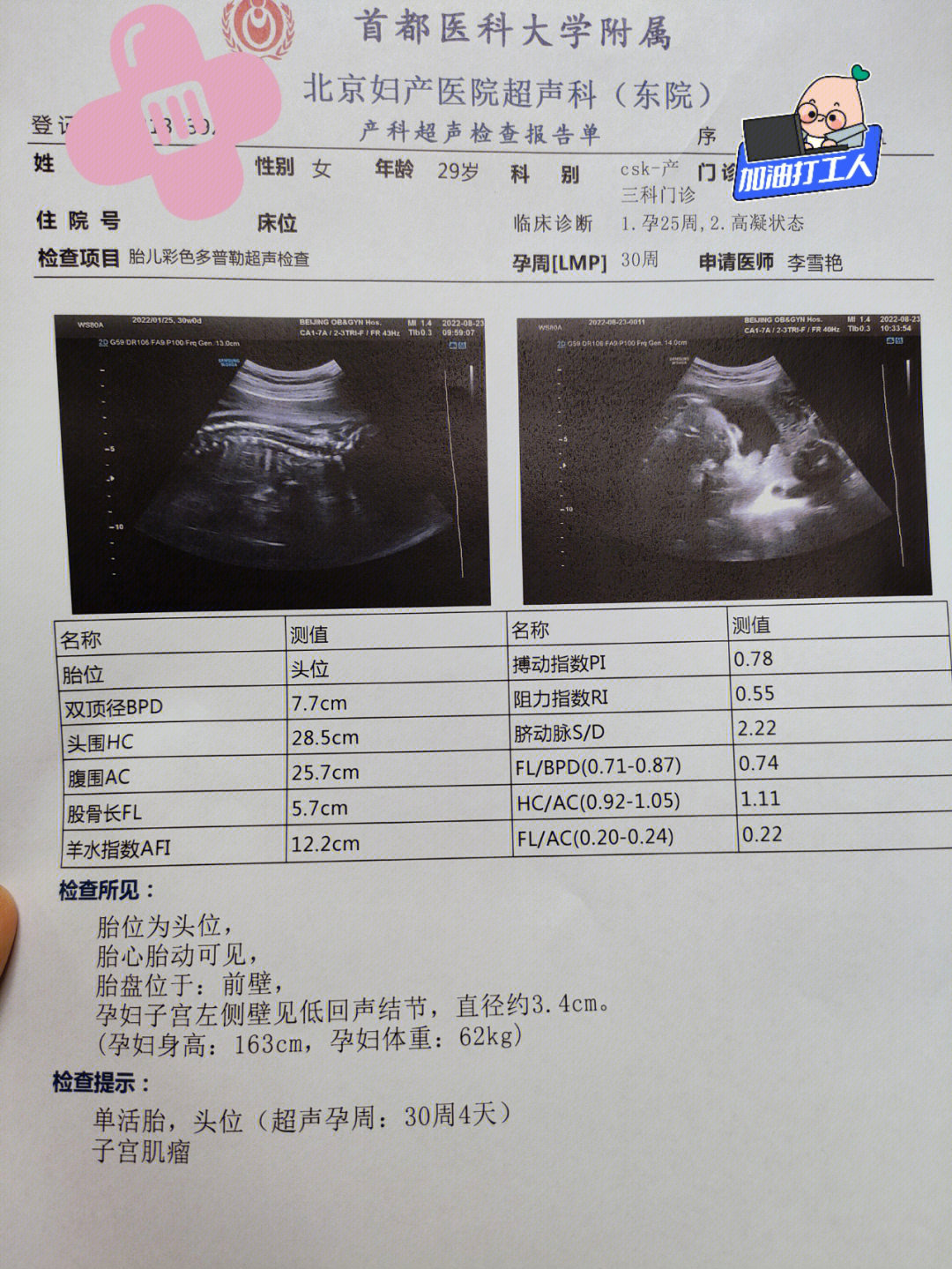 怀孕30周是几个月图片