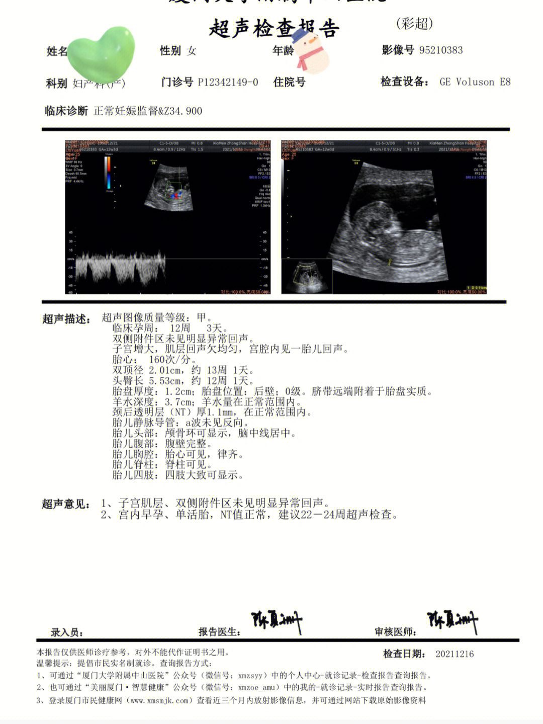 nt三条线影像图解图片