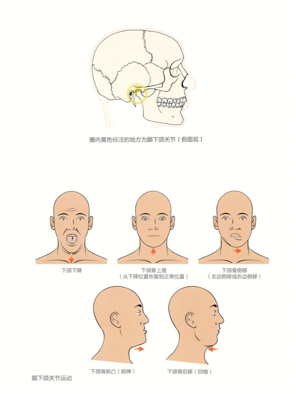 包括:· 颞下颌关节和面部疼痛· 张嘴幅度受限· 头痛· 肌肉疼痛