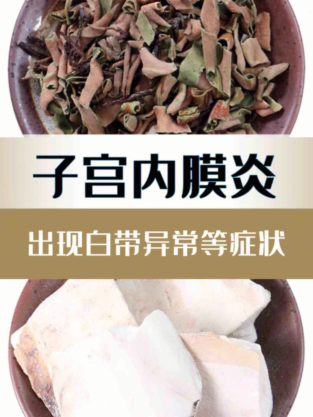 附件炎的症状图片图片