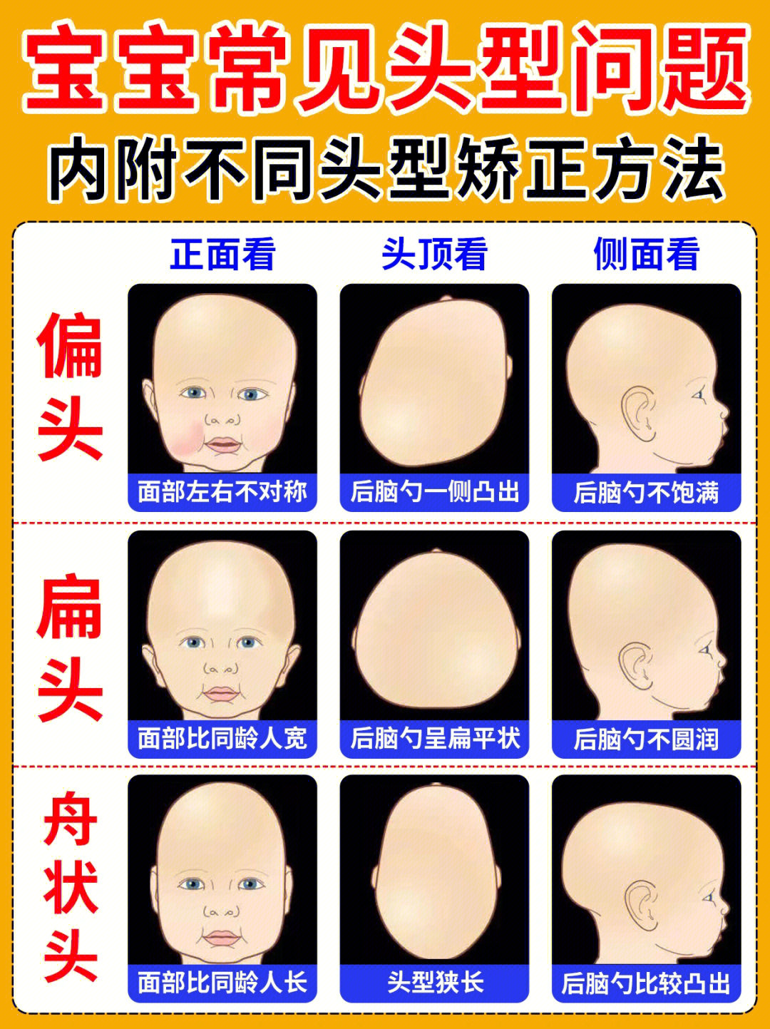 如何判断宝宝头型?婴儿头型到底怎么睡?不同头型如何矫正?