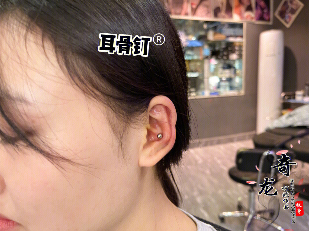 耳骨钉