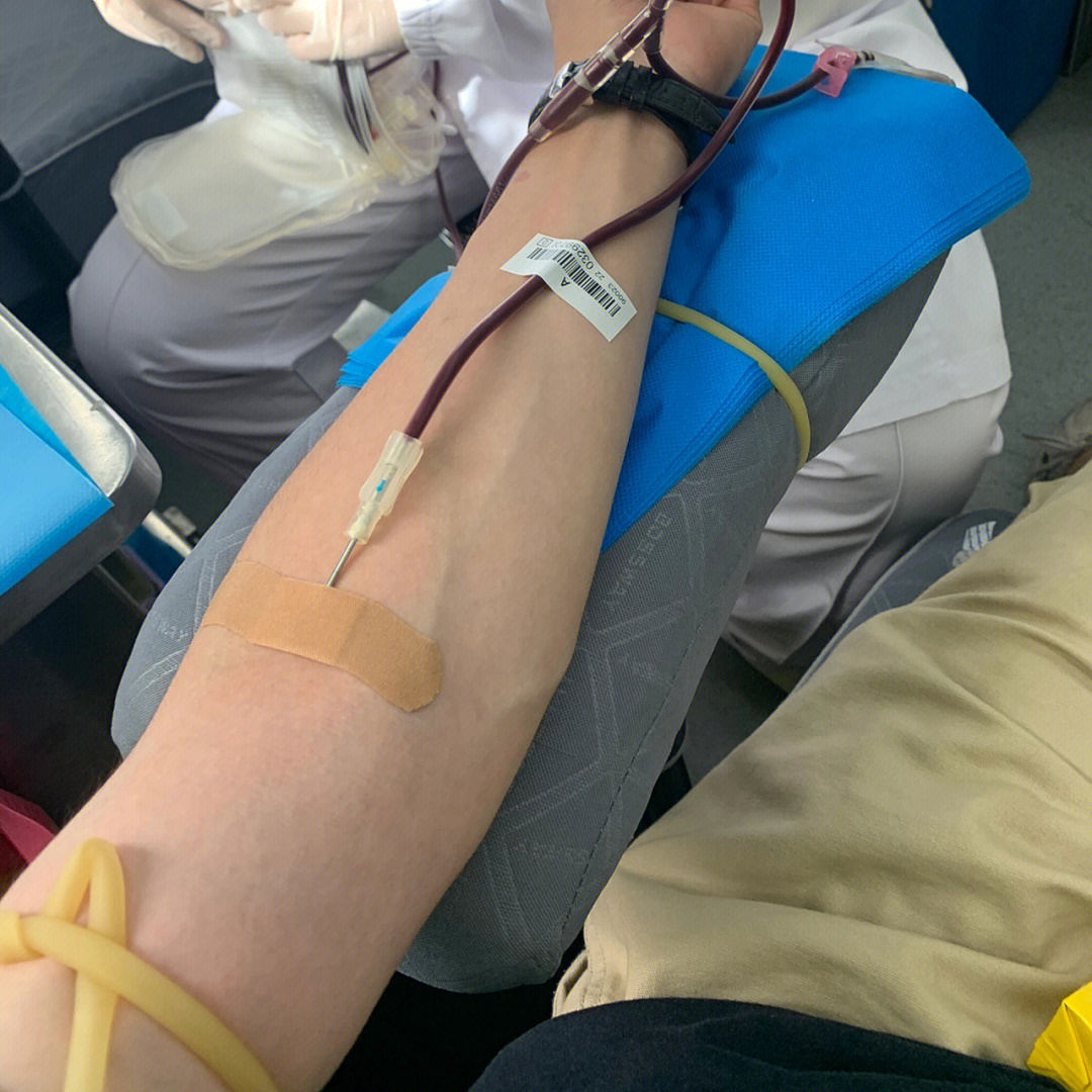 献血图片真实 手臂图片