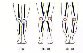 孩子x型腿按摩图解图片