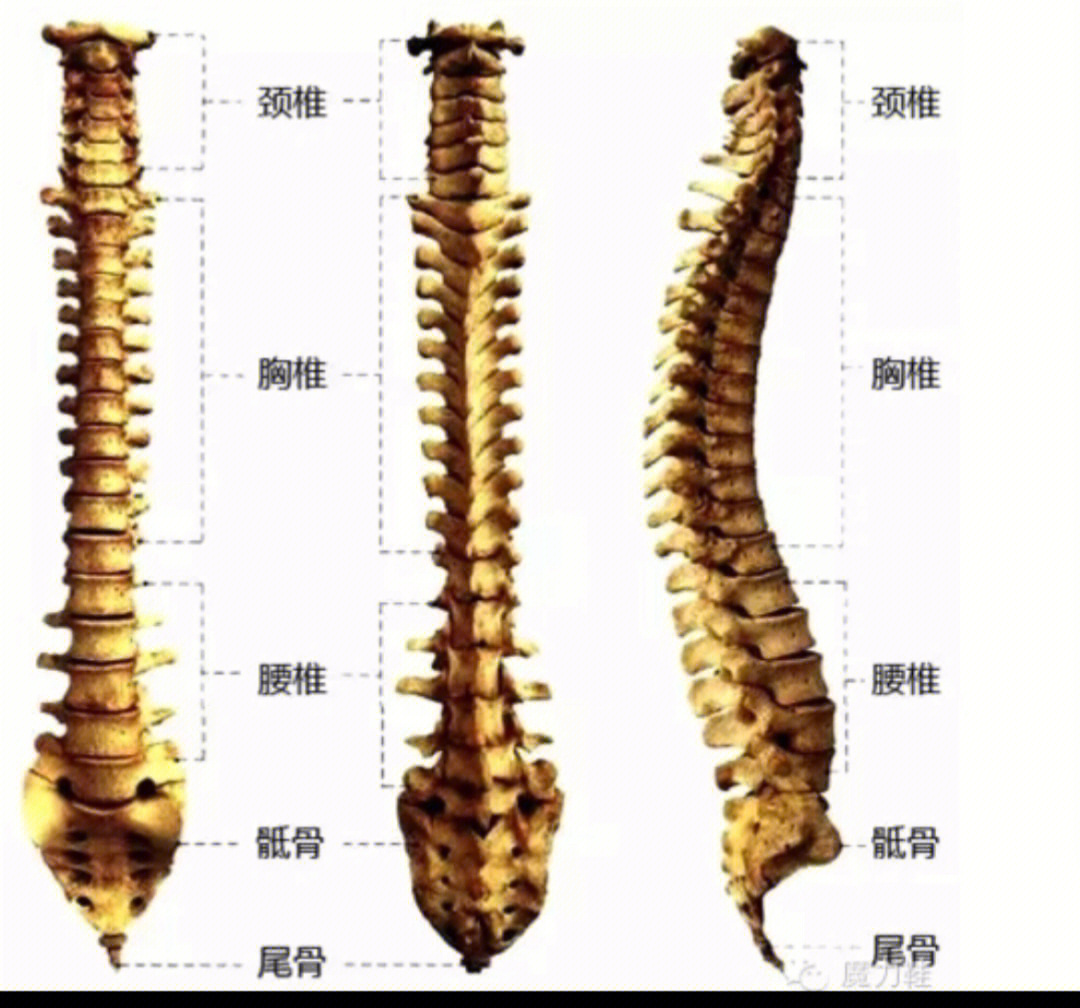 脊椎正常曲度图片图片