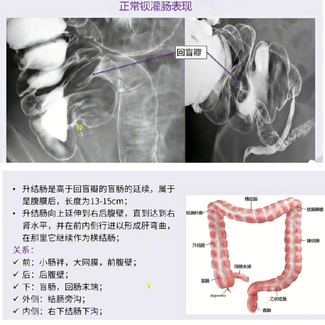 医学影像学胃肠ct大肠影像解剖下