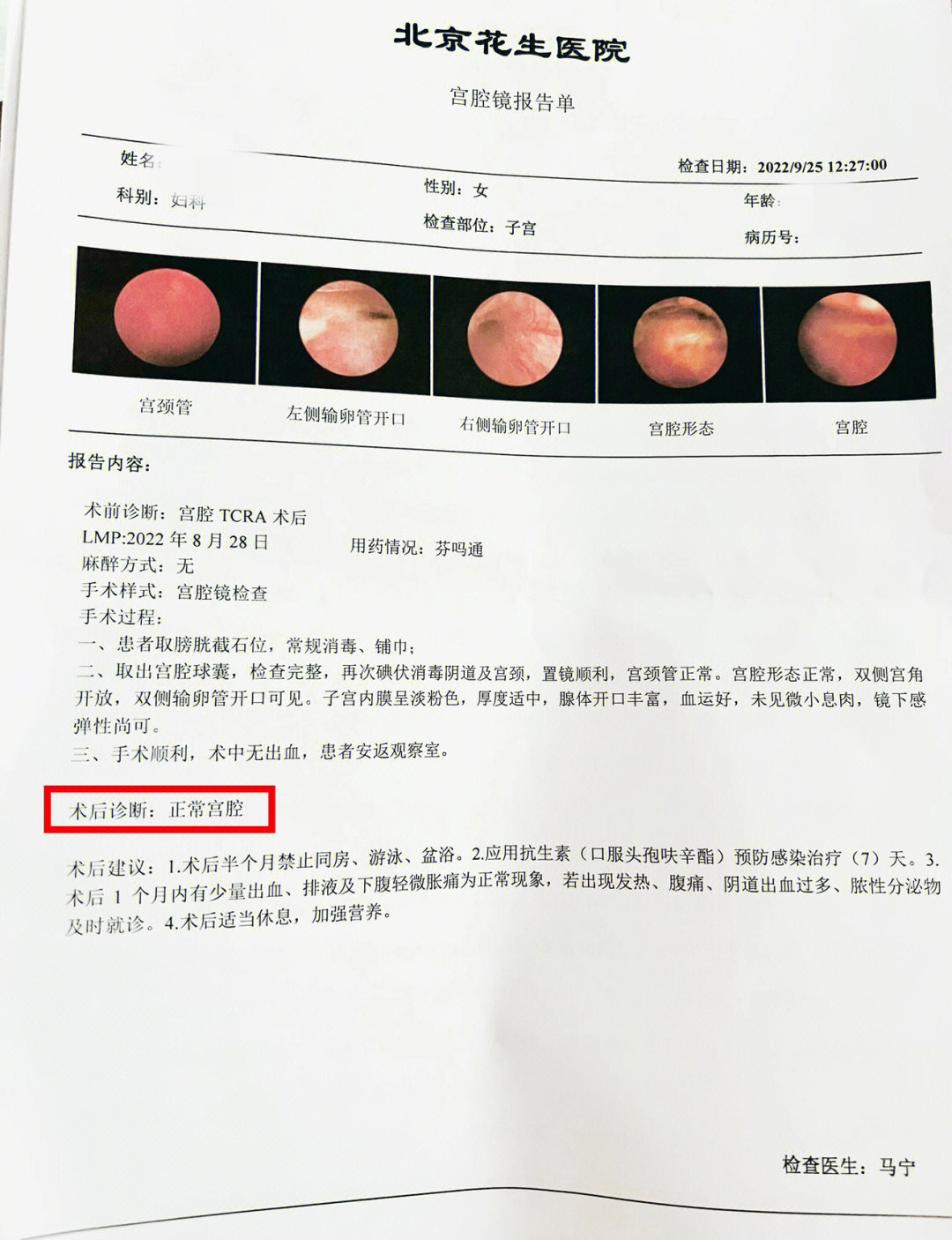 宫腔粘连报告图片