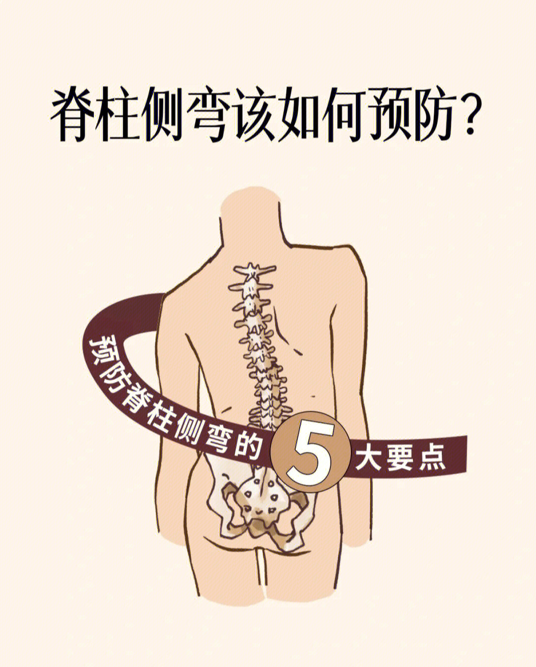 如何正确预防脊柱侧弯牢记这五点75
