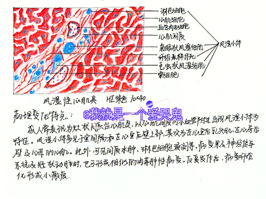 病理切片