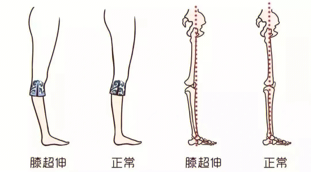 10个月宝宝驼背图片图片