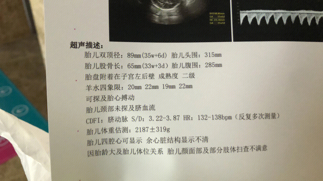 36周胎儿发育标准数据图片