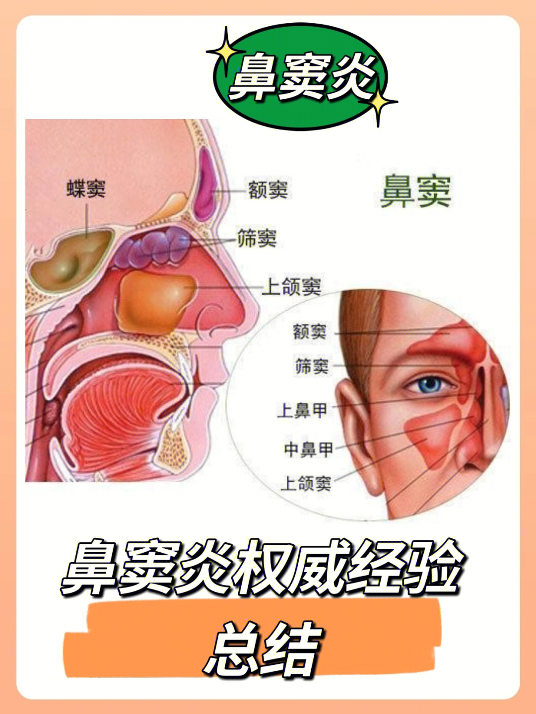 鼻窦位置图片图片