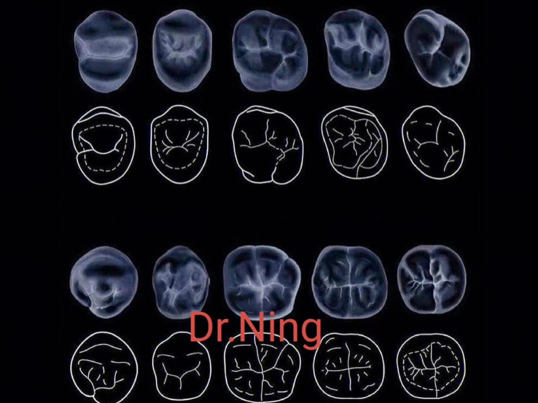 后牙骨性图片