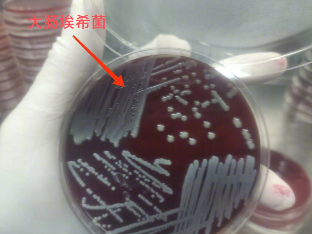 大肠埃希菌图片 手绘图片