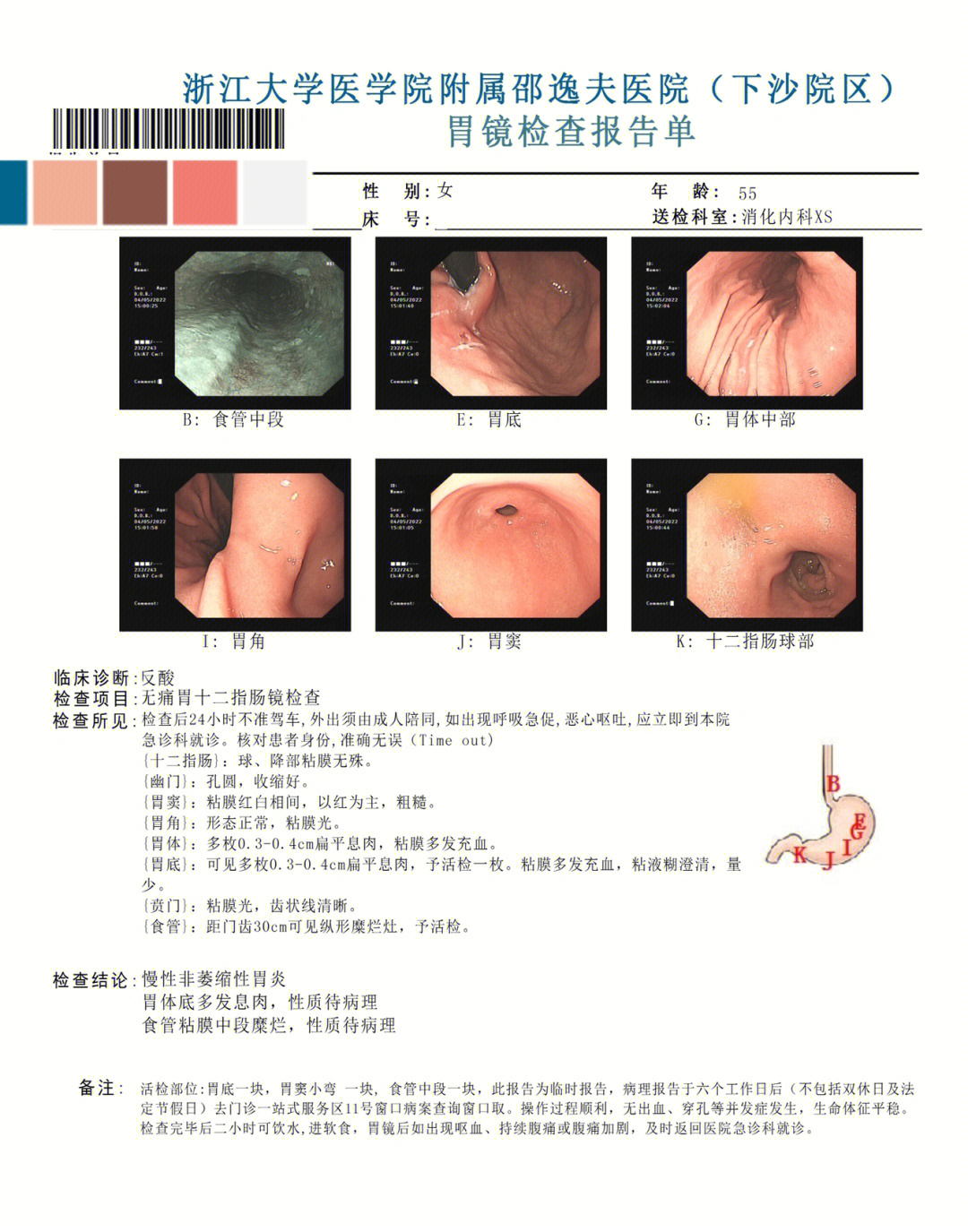 无痛肠胃镜检查的利弊图片