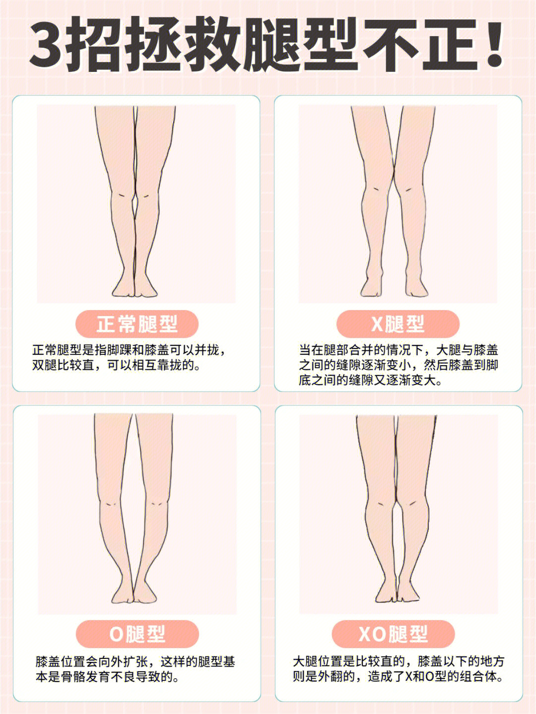 xo型腿严重713招矫正成漫画腿60