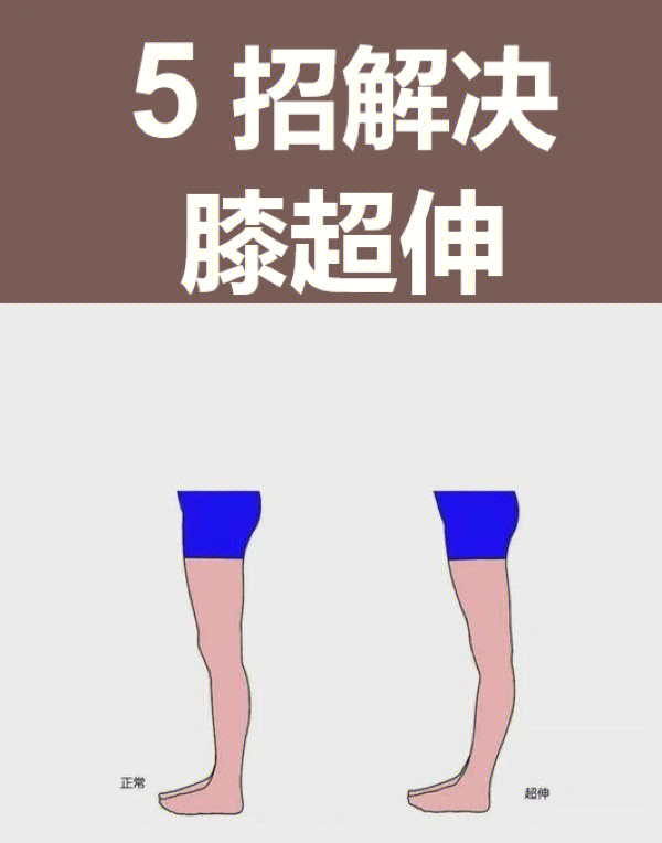 膝盖超伸矫正六个动作图片