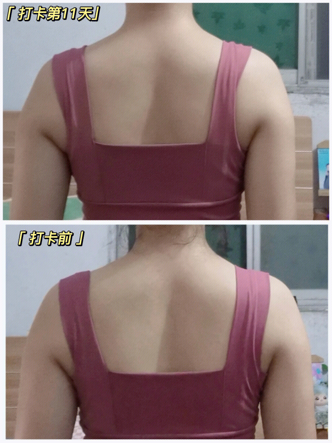 笔记灵感16615分钟迷人肩颈全套打造改善圆肩驼背针对少女背,直角肩