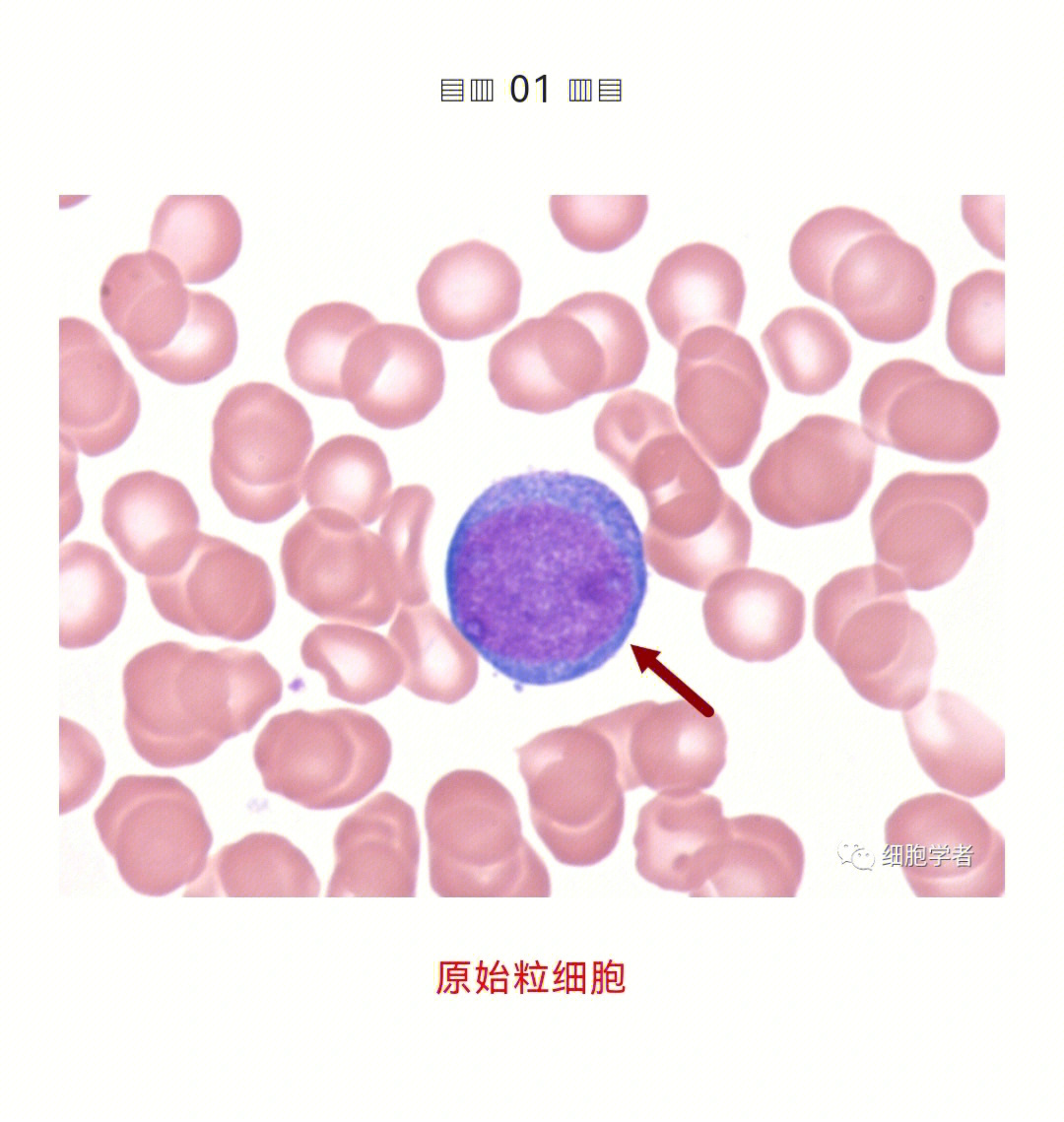 原始粒细胞胞核颜色图片