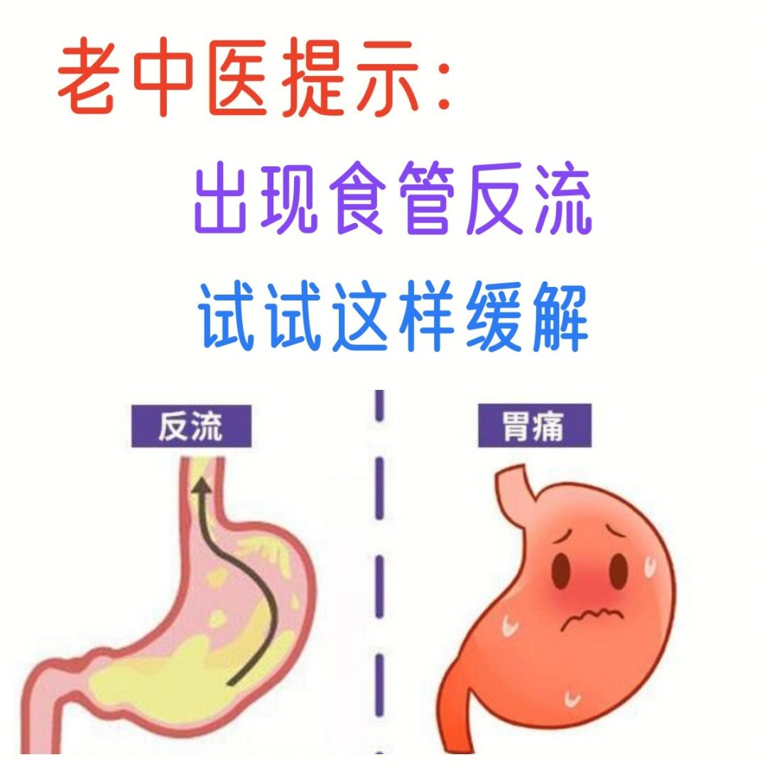 我是中医消化科专家:刘竺华,今天给大家分享一下反流性食管炎:通常是