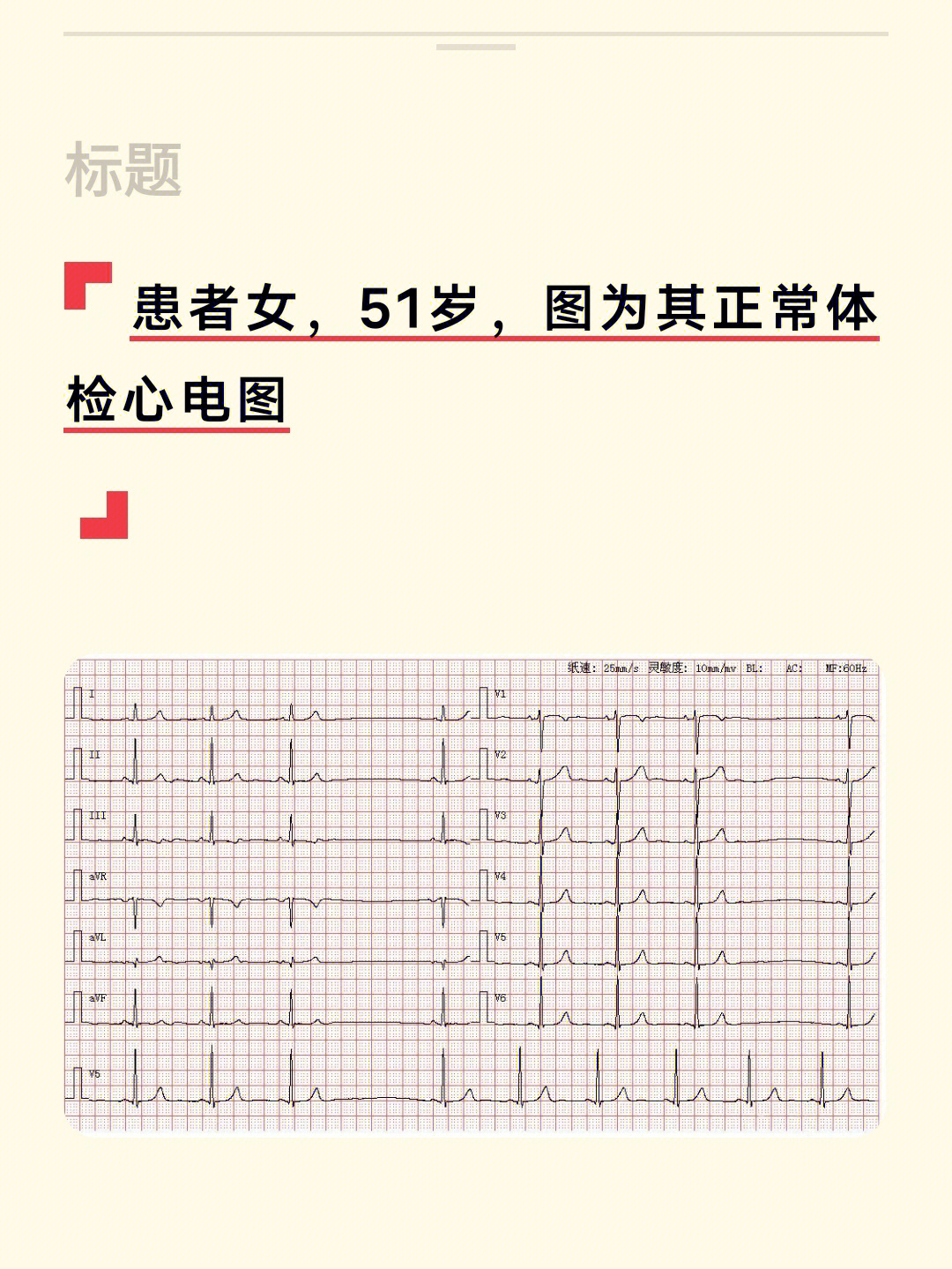 心电图  #每日一练  #医学生笔记  #临床医学  #临床医学考研  #医学