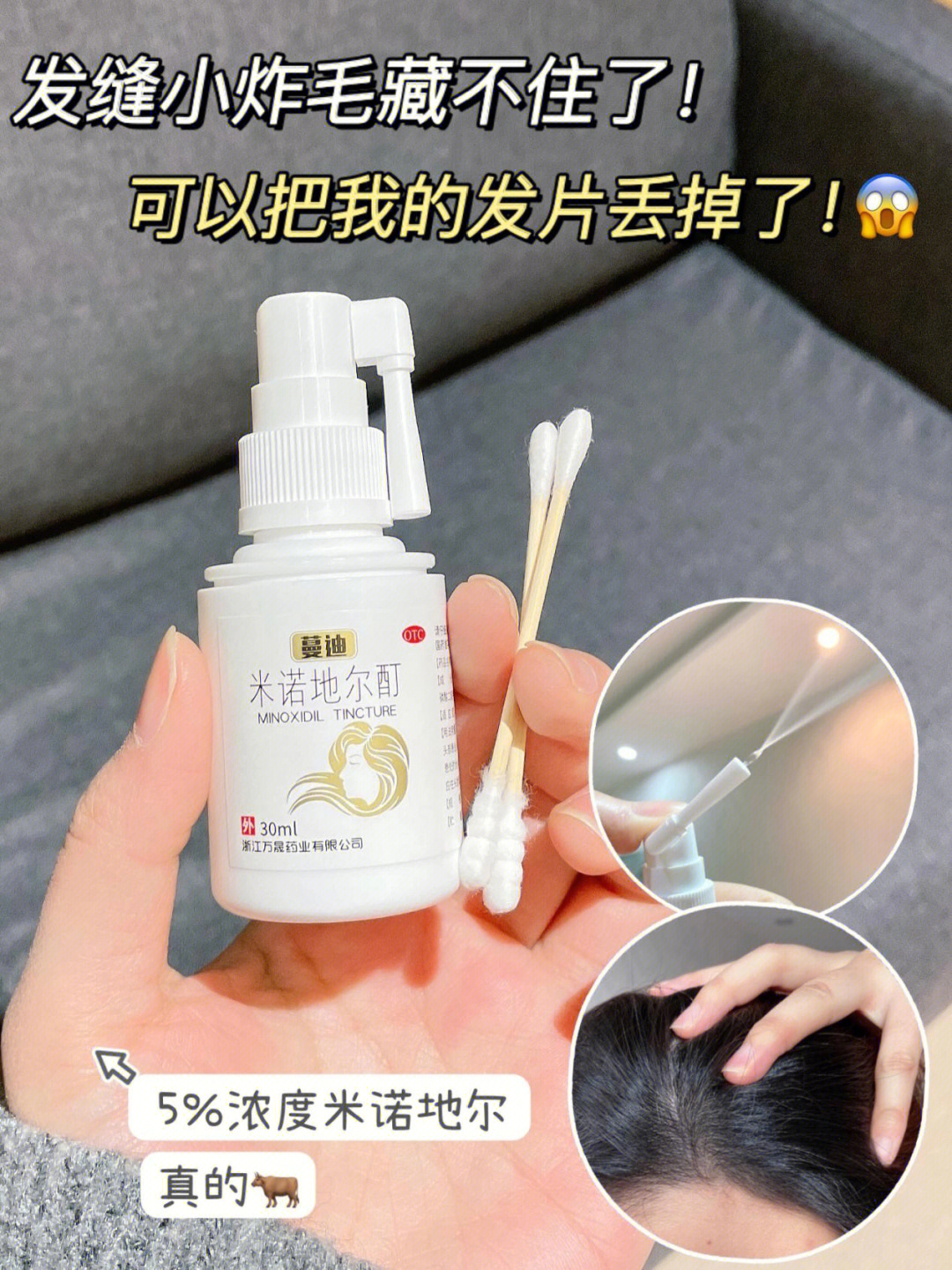 米诺地尔酊停用图片